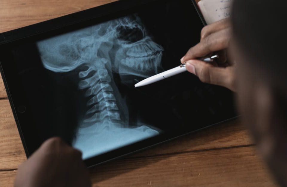 découvrez les causes, symptômes et traitements de la compression des disques cervicaux. informez-vous sur cette affection courante du cou et comment soulager la douleur pour améliorer votre qualité de vie.