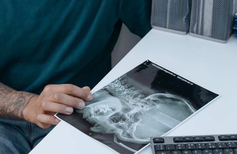 découvrez tout sur le rétrécissement foraminal cervical : ses causes, symptômes et traitements. apprenez comment cette condition affecte votre santé et les options disponibles pour soulager la douleur et améliorer votre qualité de vie.