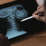 Décompression neurovertébrale : une thérapie reconnue pour améliorer la mobilité des patients atteints de sténose spinale 4 découvrez les avantages de la décompression spinale, une technique innovante pour soulager les douleurs dorsales et améliorer la santé de votre colonne vertébrale. apprenez comment ce traitement spécialisé peut favoriser une meilleure mobilité et réduire les tensions.