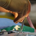 la sténose spinale est un rétrécissement du canal rachidien qui peut provoquer des douleurs, des engourdissements et une faiblesse. découvrez les symptômes, les causes et les options de traitement pour soulager ce conditionnement qui affecte la qualité de vie.