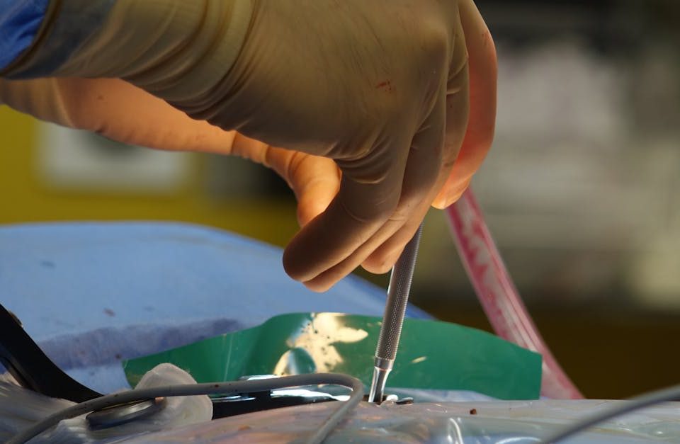 la sténose spinale est un rétrécissement du canal rachidien qui peut provoquer des douleurs, des engourdissements et une faiblesse. découvrez les symptômes, les causes et les options de traitement pour soulager ce conditionnement qui affecte la qualité de vie.