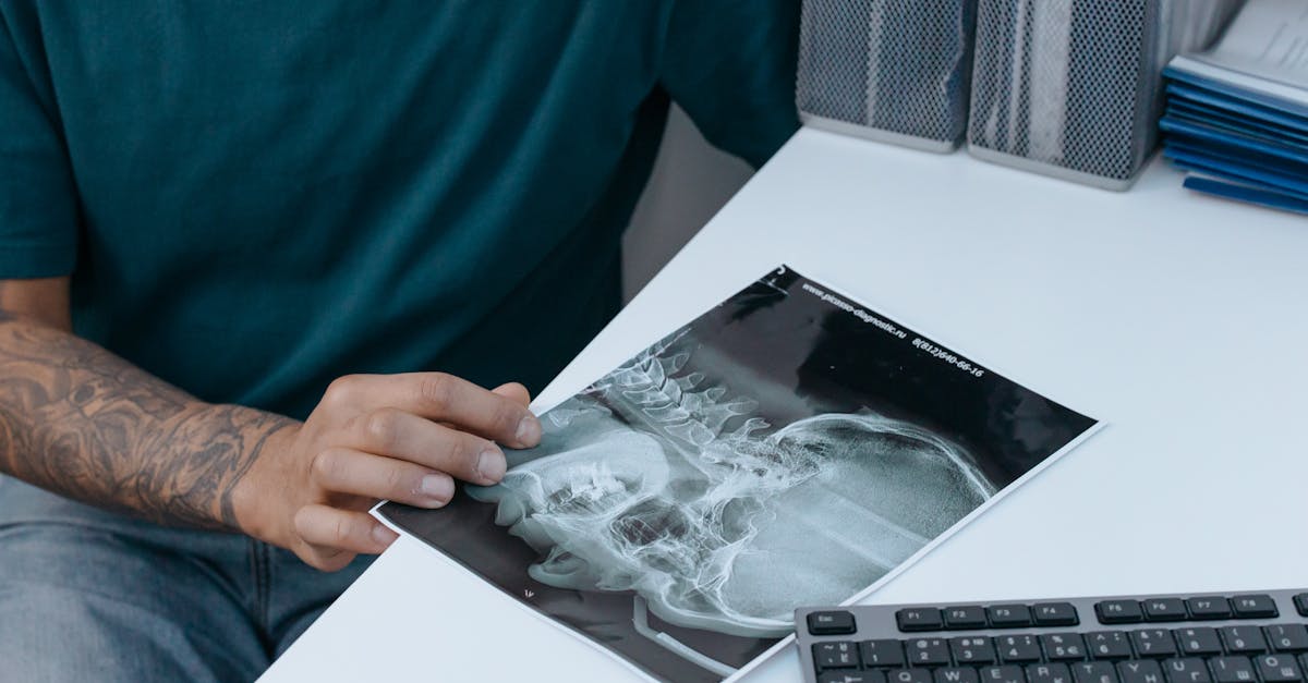 découvrez les bienfaits de la décompression cervicale : une méthode efficace pour soulager la douleur et améliorer la mobilité du cou. explorez les techniques et conseils pour une meilleure santé cervicale.