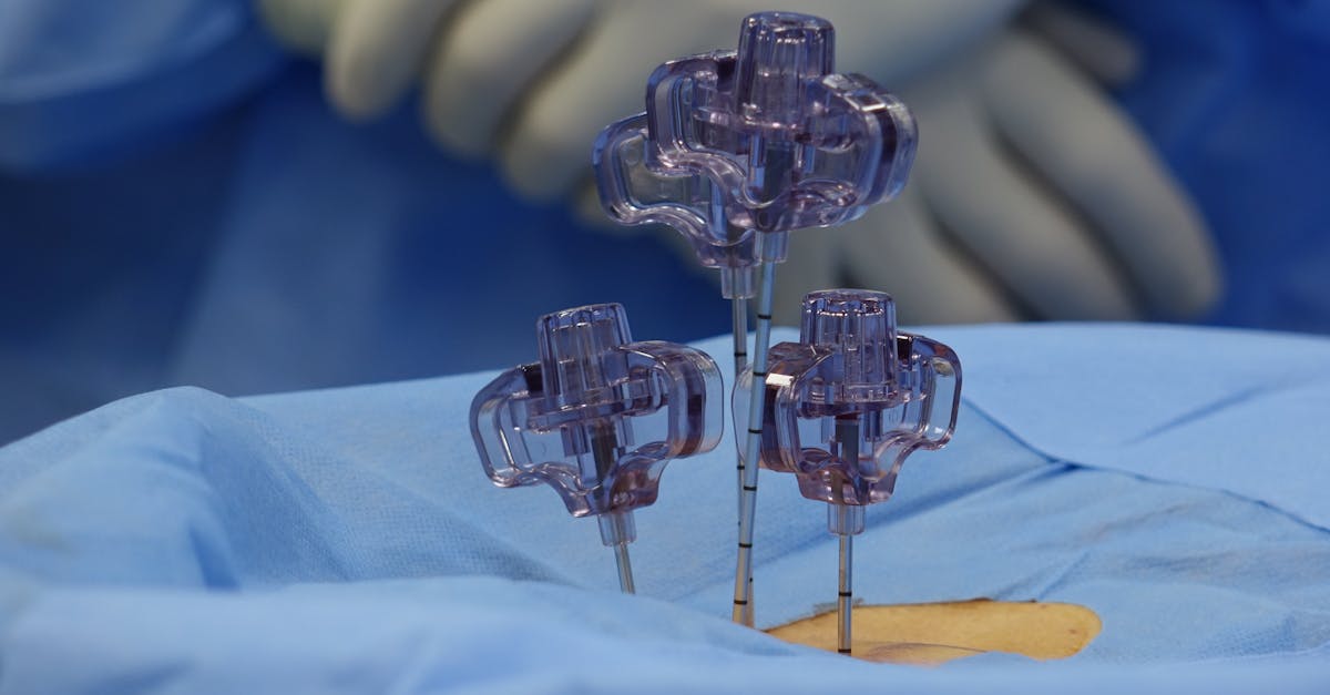 découvrez tout sur le diagnostic de la sténose spinale, une condition qui entraîne un rétrécissement du canal rachidien. apprenez les symptômes, les méthodes de diagnostic et les options de traitement disponibles pour améliorer votre qualité de vie.