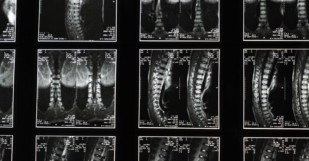 découvrez les différentes affections cervicales, leurs symptômes, traitements et conseils pour soulager les douleurs au cou. informez-vous sur les causes et améliorez votre bien-être avec des recommandations simples.
