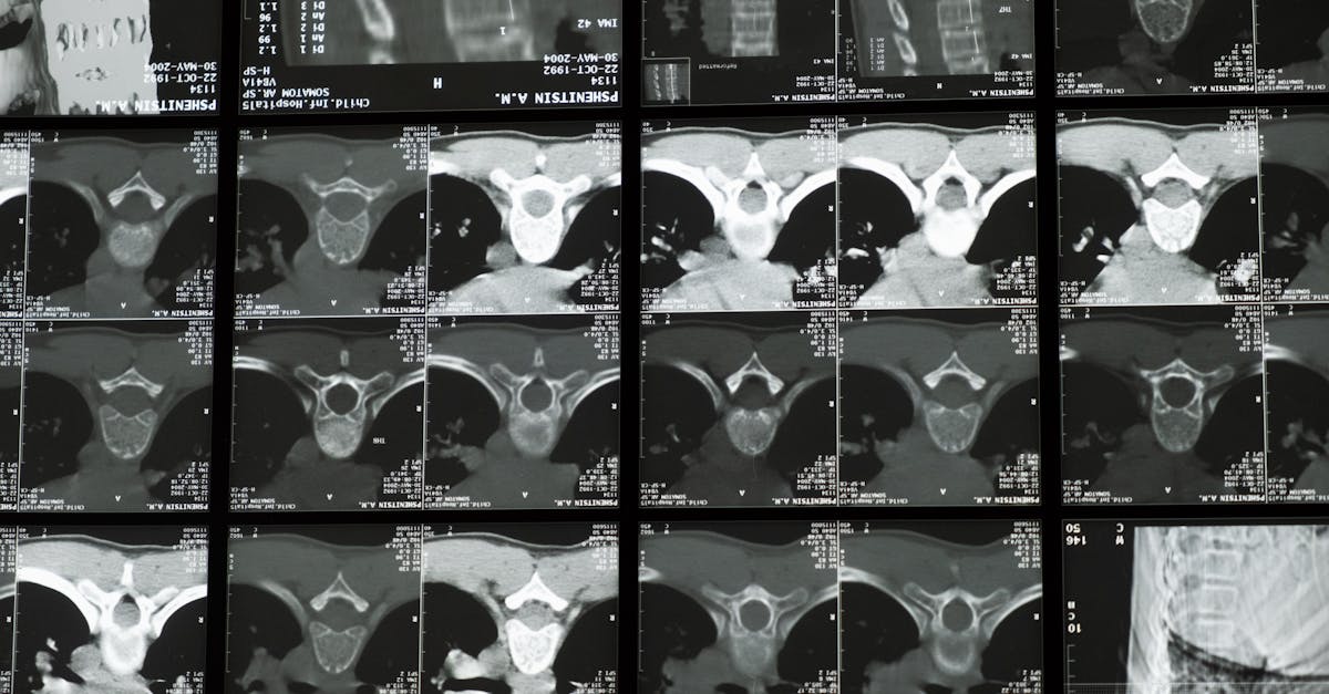 découvrez tout sur les cervicales : causes, symptômes et traitements des douleurs cervicales. informez-vous sur les solutions efficaces pour améliorer votre bien-être et prévenir les maux de cou.