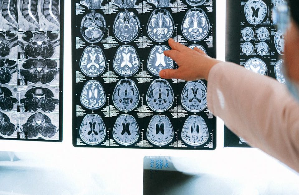 découvrez notre service de diagnostic pour identifier rapidement et efficacement les problèmes de votre appareil ou système. profitez d'une expertise professionnelle et de solutions adaptées pour garantir performance et longévité.