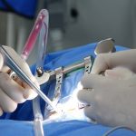 découvrez les causes, symptômes et traitements de la sténose spinale, une affection qui entraîne un rétrécissement du canal spinal, provoquant douleurs et difficultés de mobilité. obtenez des conseils pour gérer cette condition dans notre guide complet.