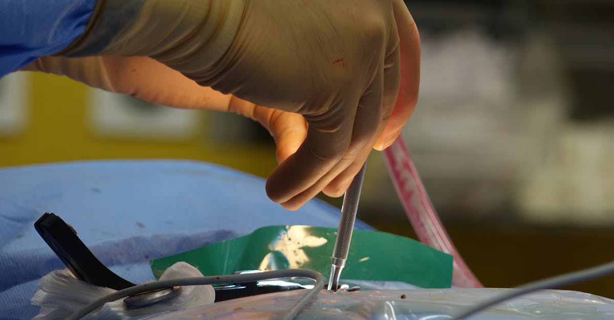 la sténose foraminale est une condition médicale où les ouvertures dans la colonne vertébrale se rétrécissent, compressant ainsi les nerfs spinal. découvrez les causes, symptômes et traitements de cette affection qui peut provoquer des douleurs et des engourdissements.