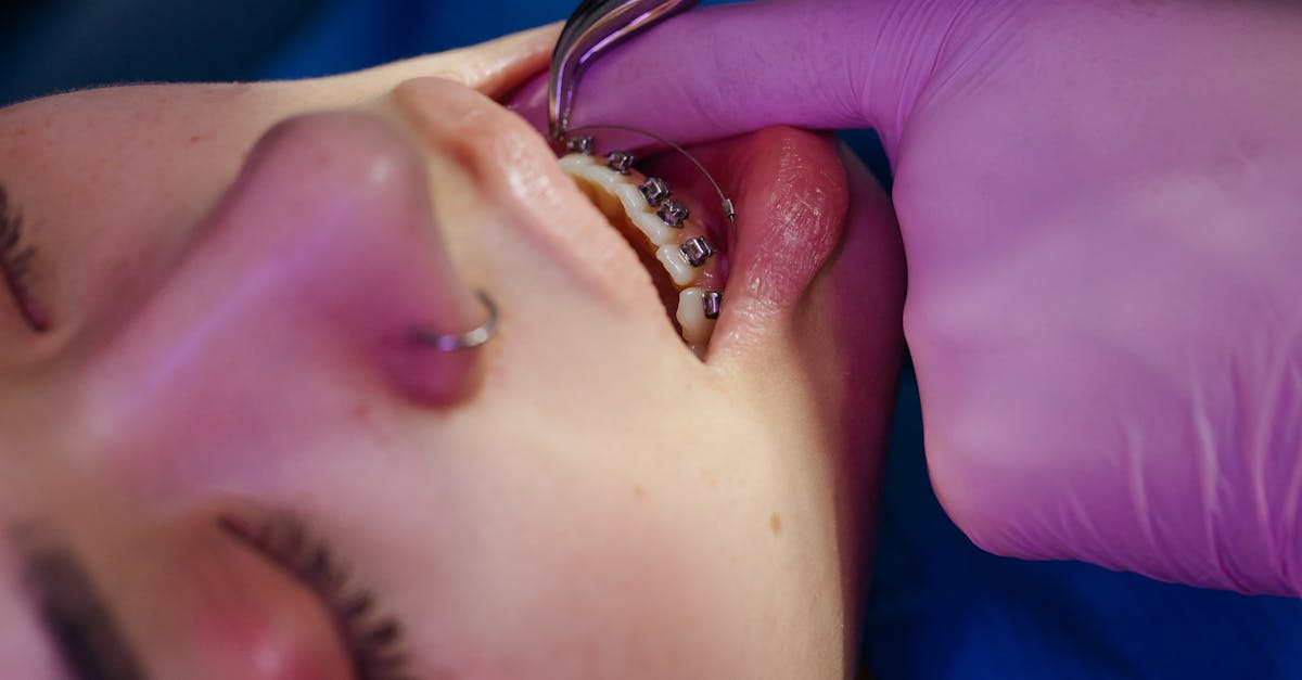 Les ajustements post-traitement nécessaires pour prévenir les récidives de pincement discal 7 découvrez les ajustements post-traitement essentiels pour optimiser vos résultats. apprenez comment adapter vos soins après un traitement pour garantir une guérison optimale et un bien-être durable.