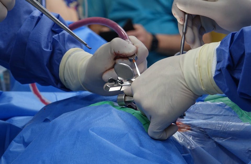 découvrez les bienfaits de la décompression spinale, une méthode non chirurgicale pour soulager les douleurs dorsales et améliorer la santé de votre colonne vertébrale. apprenez comment cette technique peut vous aider à retrouver mobilité et confort au quotidien.