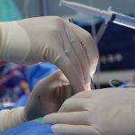 découvrez tout sur la sténose spinale : causes, symptômes et traitements de cette condition qui provoque un rétrécissement du canal rachidien, entraînant douleur et inconfort. informez-vous sur les solutions pour améliorer votre qualité de vie.