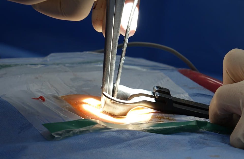 découvrez tout sur la sténose spinale, une condition qui provoque un rétrécissement du canal vertébral. apprenez à reconnaître ses symptômes, ses causes et les options de traitement disponibles pour soulager la douleur et améliorer votre qualité de vie.