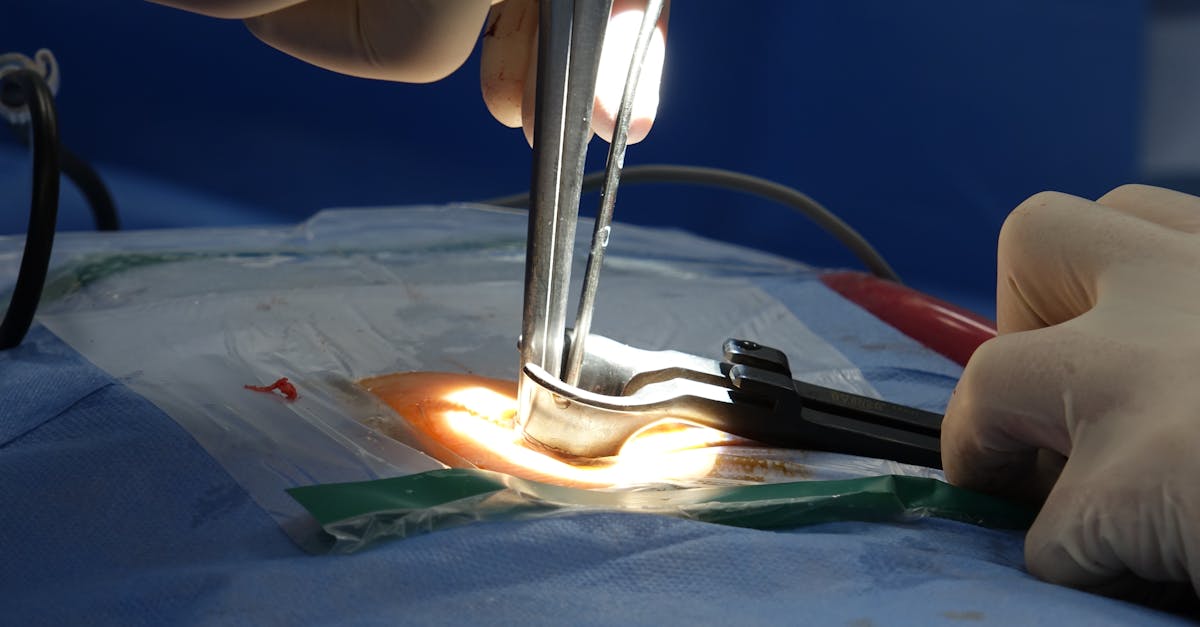 Les protocoles avancés pour traiter efficacement la sténose spinale complexe 4 découvrez tout sur la sténose spinale, une condition qui provoque un rétrécissement du canal vertébral. apprenez à reconnaître ses symptômes, ses causes et les options de traitement disponibles pour soulager la douleur et améliorer votre qualité de vie.