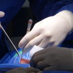 découvrez les méthodes et spécialisations pour le diagnostic de la sténose spinale. informez-vous sur les symptômes, les examens et les traitements disponibles pour améliorer votre qualité de vie.