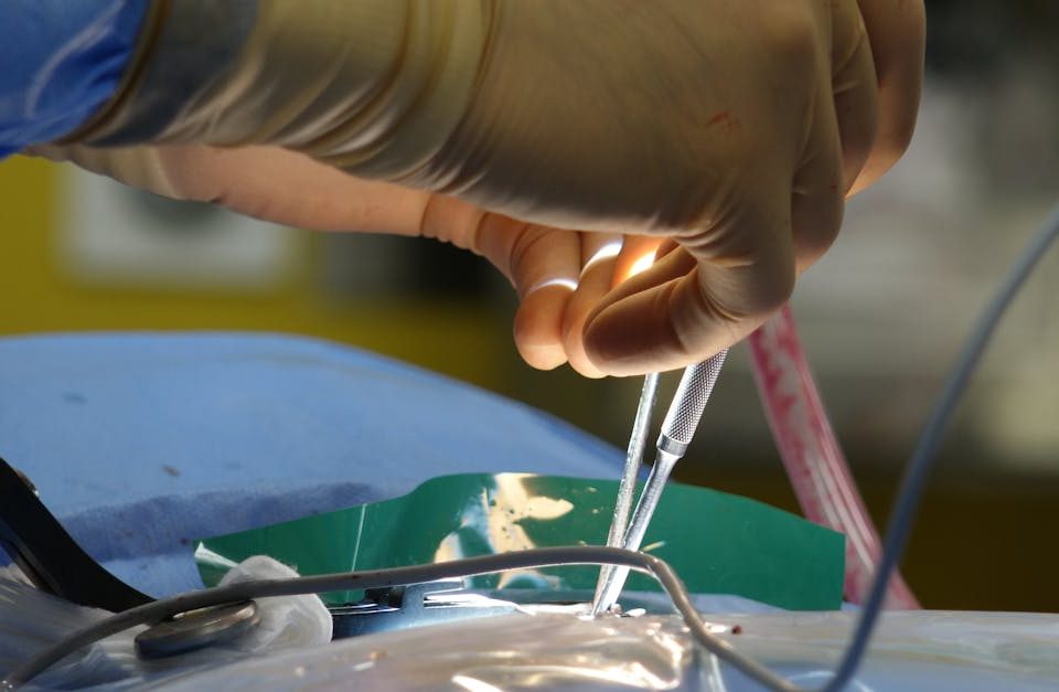 la sténose foraminale est un rétrécissement des ouvertures par lesquelles passent les nerfs dans la colonne vertébrale, pouvant provoquer douleur, engourdissement et faiblesse. découvrez les causes, symptômes et options de traitement pour soulager cette condition.