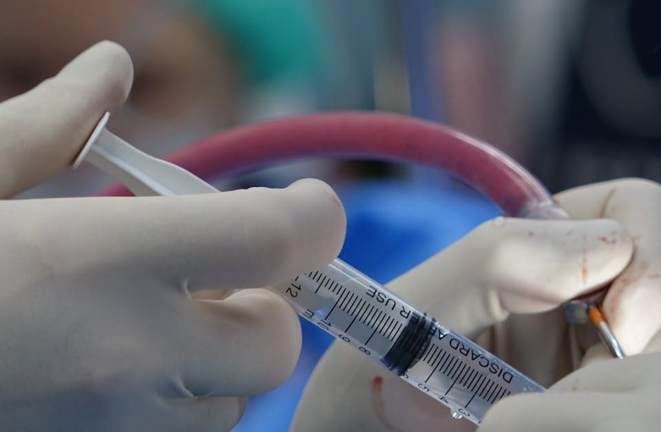 découvrez tout sur la sténose foraminale, une condition qui provoque des douleurs et des engourdissements. apprenez-en plus sur ses causes, ses symptômes et les options de traitement disponibles pour améliorer votre qualité de vie.