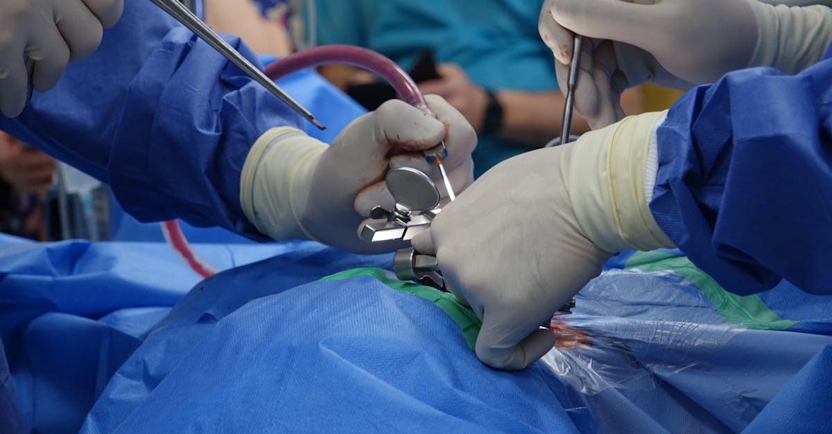 découvrez la décompression spinale : une technique innovante pour soulager les douleurs dorsales, améliorer la mobilité et traiter les problèmes de colonne vertébrale sans chirurgie. informations, bienfaits et conseils pratiques.