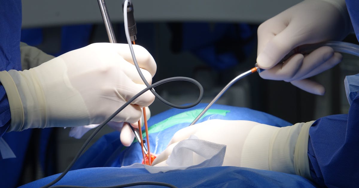 découvrez tout ce qu'il faut savoir sur la sténose foraminale : causes, symptômes, diagnostics et traitements pour soulager la douleur liée au rétrécissement du canal nerveux de la colonne vertébrale.