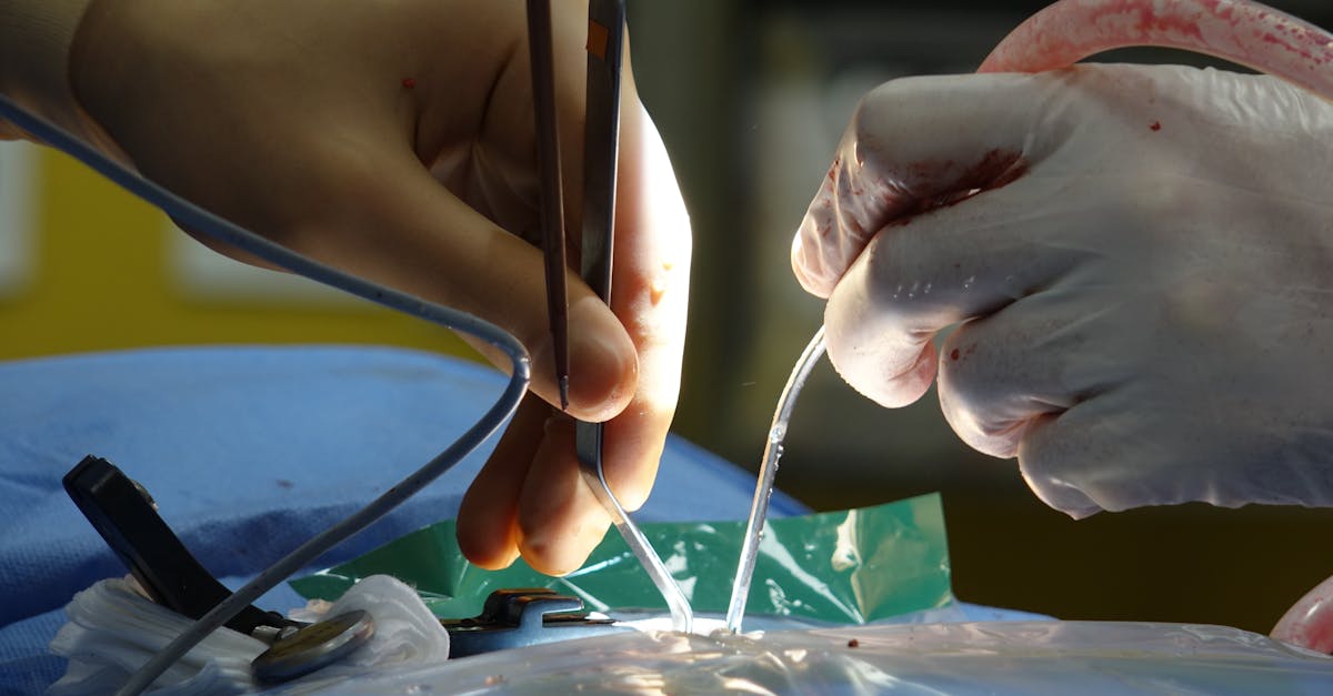 découvrez ce qu'est la sténose foraminale : causes, symptômes et options de traitement pour soulager la douleur liée au rétrécissement du canal nerveux dans la colonne vertébrale.