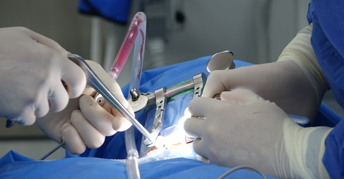 découvrez tout ce qu'il faut savoir sur la sténose foraminale : symptômes, causes, traitements et conseils pour soulager la douleur liée à ce rétrécissement des canaux nerveux de la colonne vertébrale.