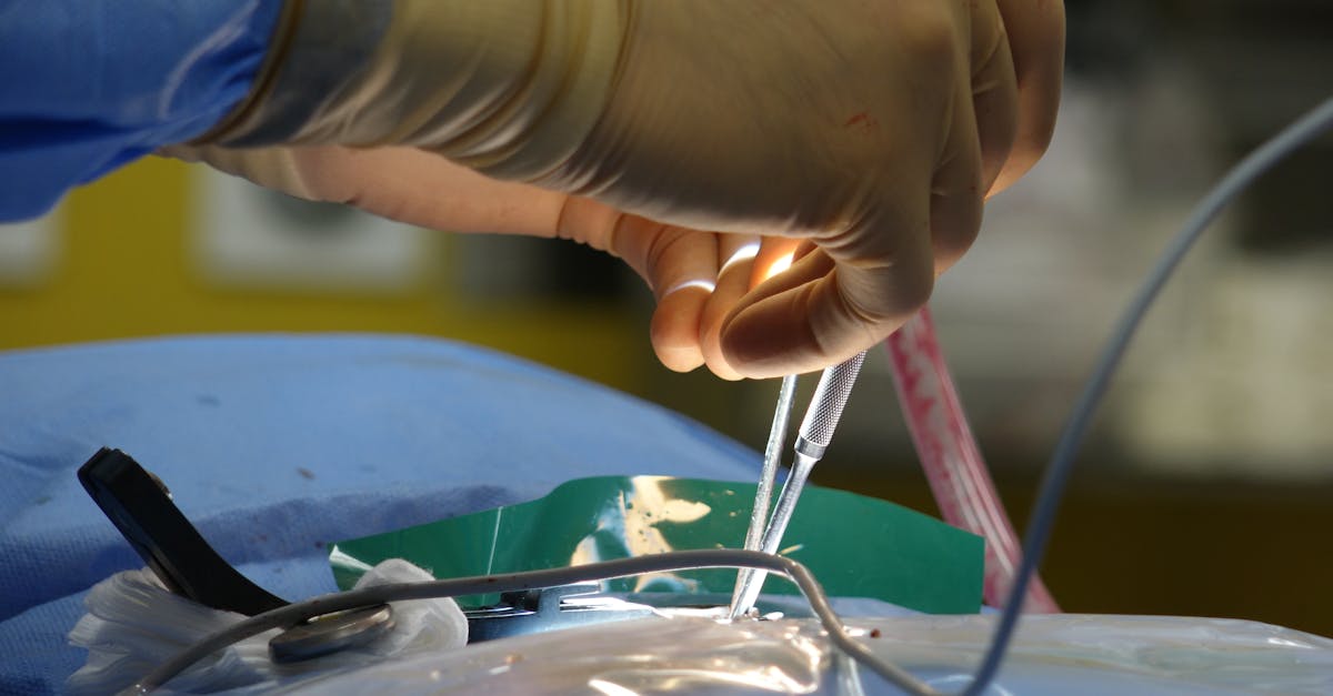 découvrez les causes, symptômes et traitements de la sténose spinale, une affection caractérisée par le rétrécissement du canal rachidien pouvant provoquer des douleurs et des troubles neurologiques. informez-vous pour mieux comprendre cette pathologie et ses solutions.