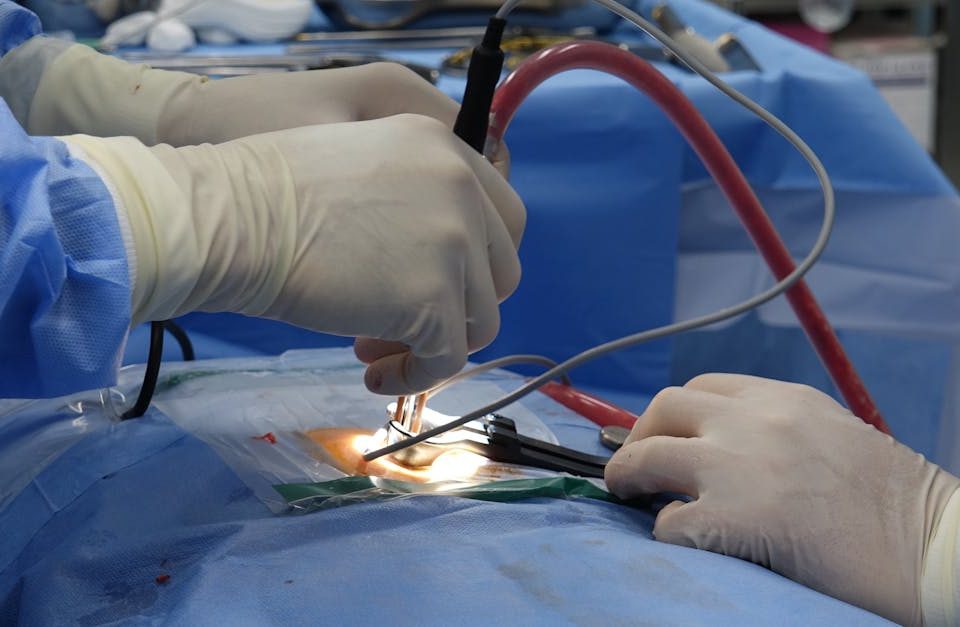 découvrez ce qu'est la sténose spinale : ses causes, ses symptômes et les options de traitement pour soulager la douleur et améliorer la qualité de vie des personnes touchées par ce rétrécissement du canal rachidien.